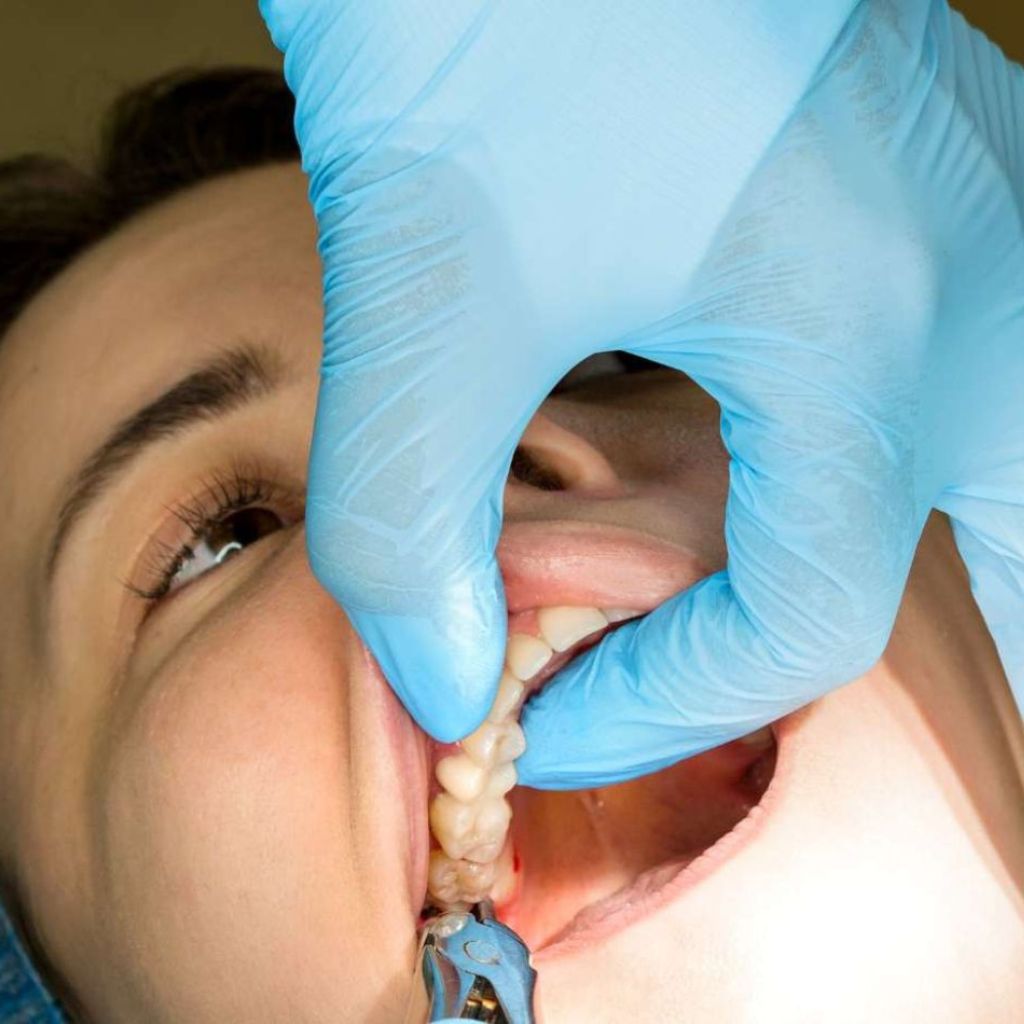 Wisdom Teeth & Painless Surgery
